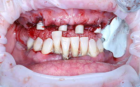 Treatment view