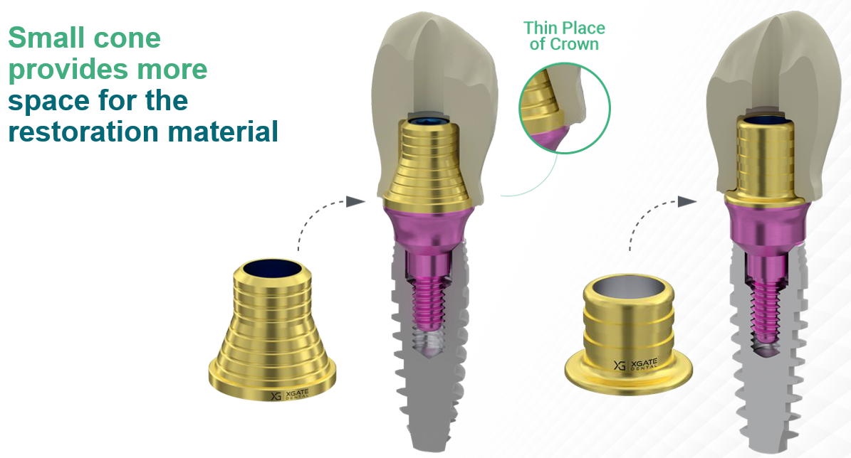 Diagram comparing abutment cones: the small V-Type cone leaves more space for the restoration material inside the crown.