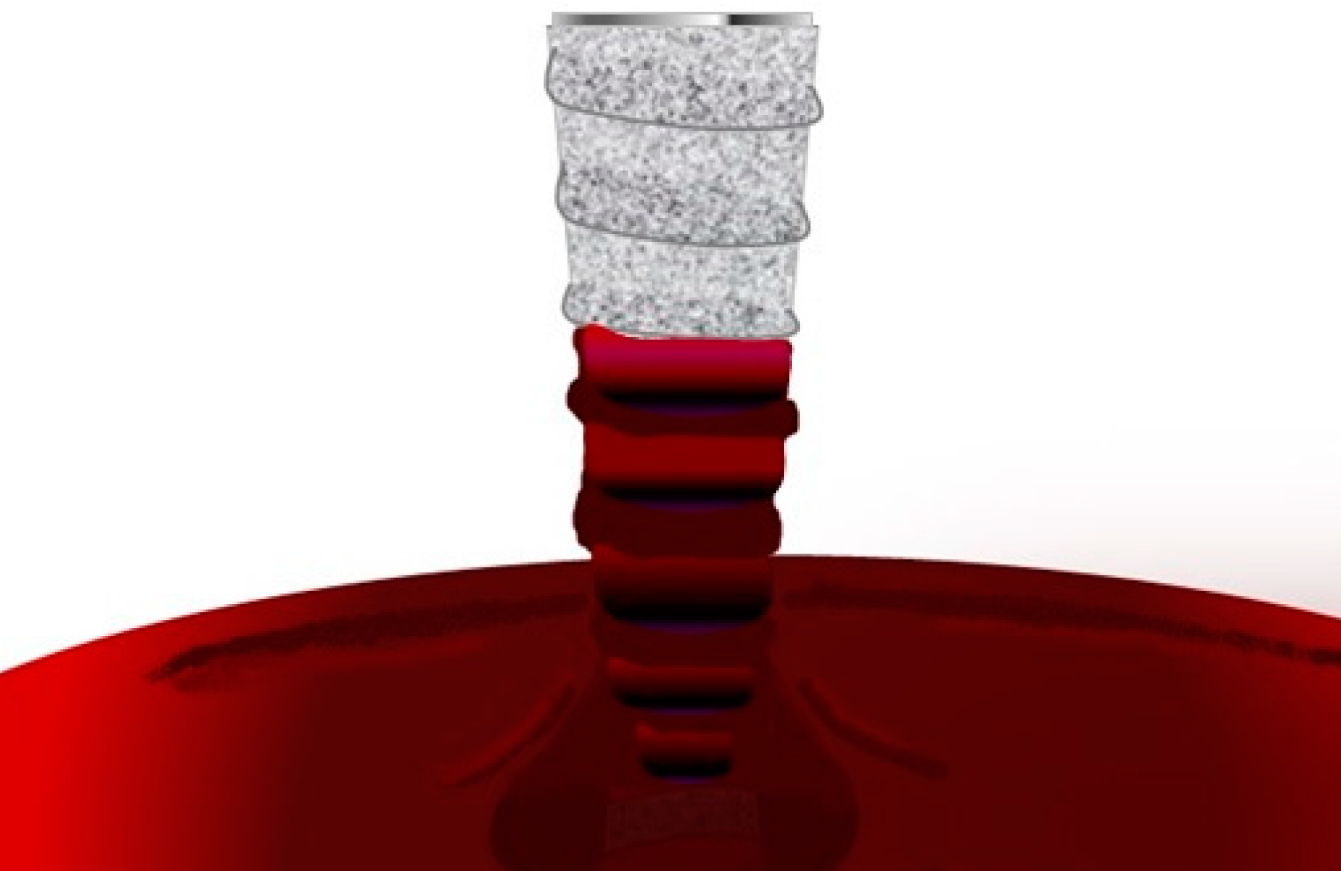 Hydrophilic dental implant surface attracting blood flow during surgical placement