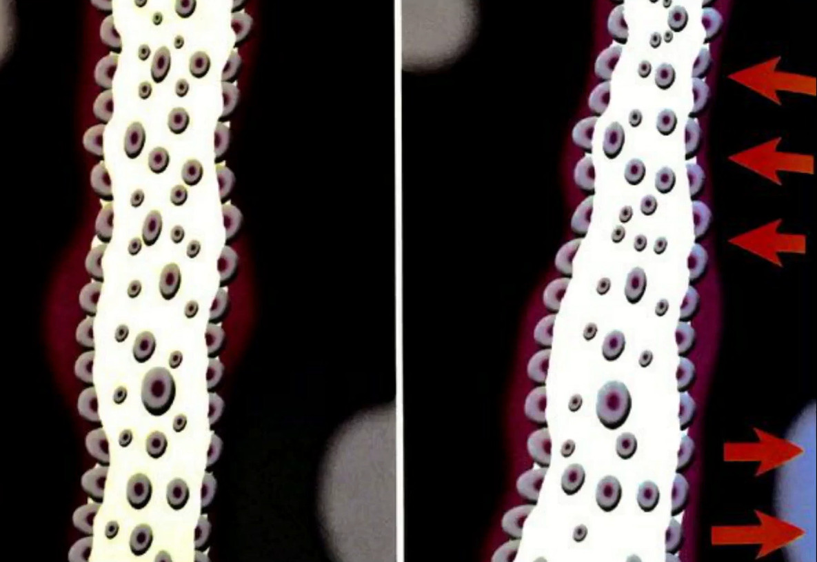 Too large a gap between the bone tissue and the implant surface