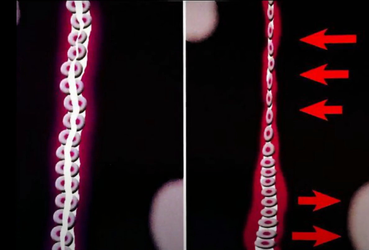 Cell destruction during implant mobility due to insufficient primary stability