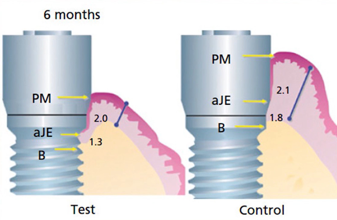 Comparison of bone and tissue levels around dental implants at 6 months showing test versus control group measurements