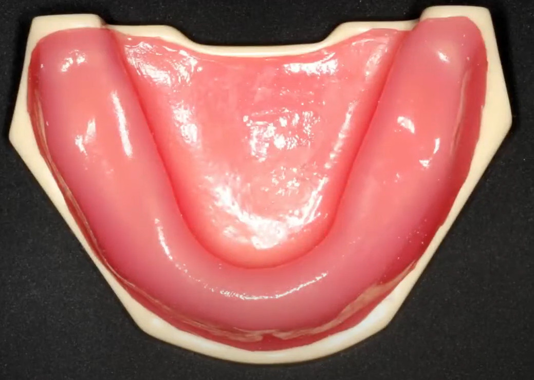Edentulous jaw model for training students and young specialists