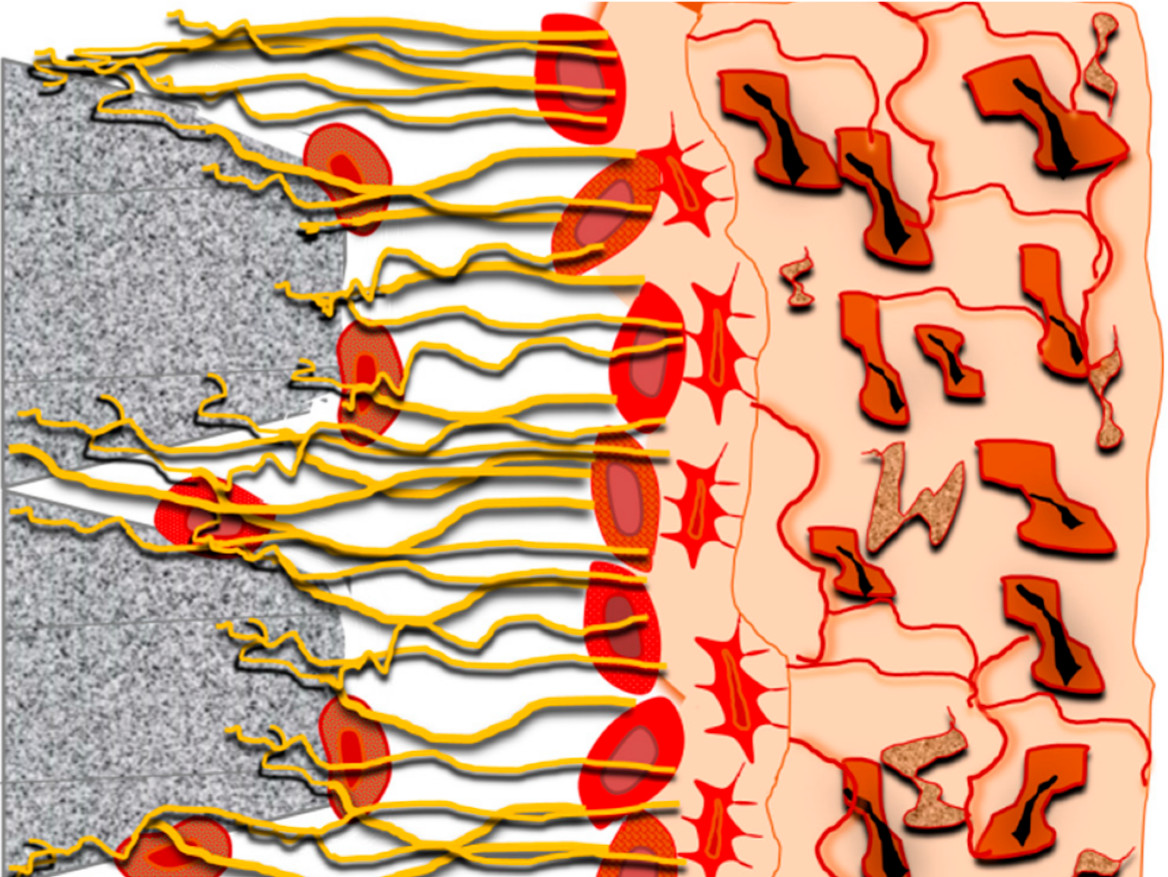Microscopic view of fibrin adhesion on textured dental implant surface
