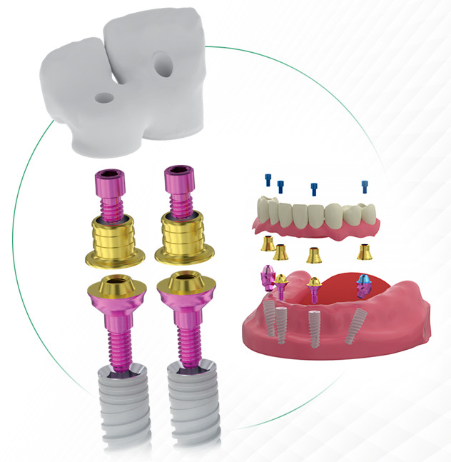 Examples of two-unit and full-arch restorations supported by multi-unit abutments.