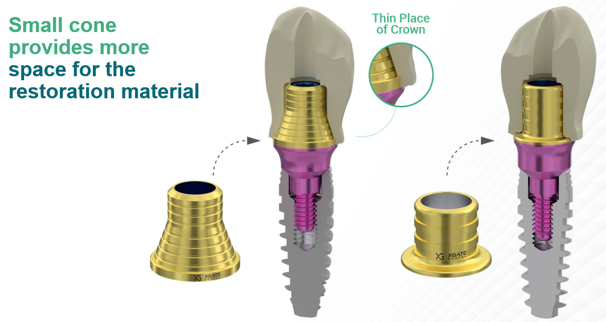 Diagram showing how a reduced abutment cone leaves more space for restorative material at the thin crown margin.