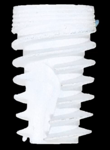 Close-up view of white threaded dental implant screw showing spiral thread design