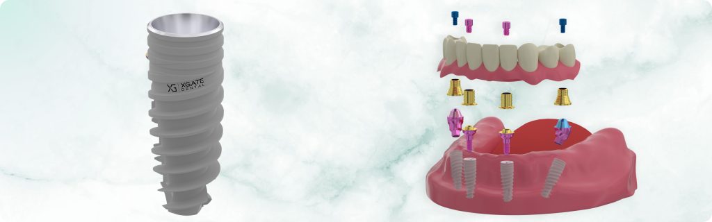 How Implant Material Changes Everything: A Comprehensive Analysis of the Mechanical Properties of Titanium, Zirconia, and PEEK in Full Arch-on-4 Restorations