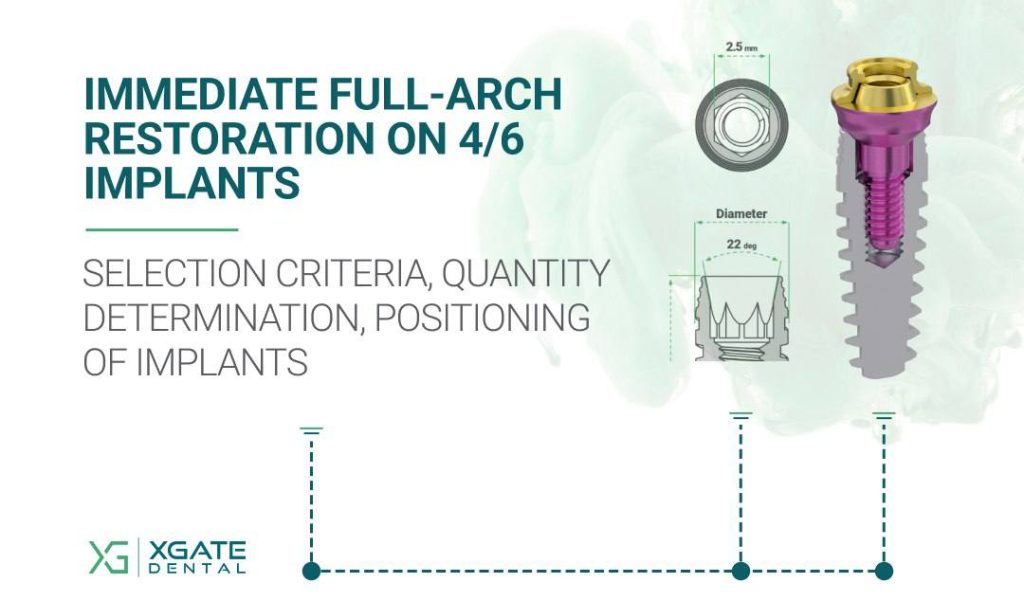 Immediate Full-Arch Restoration on 4/6 Implants. Part 2