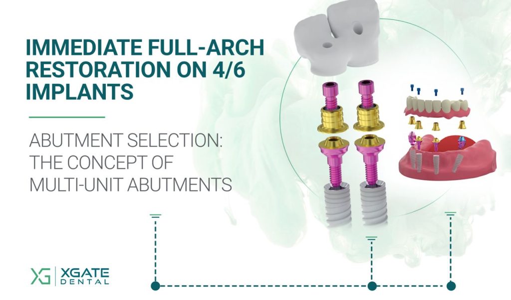 Immediate Full-Arch Restoration on 4/6 Implants. Part 3